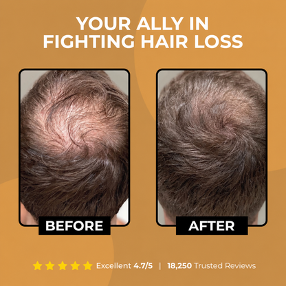 Xevyne™ Root Activator Shampoo 2.0