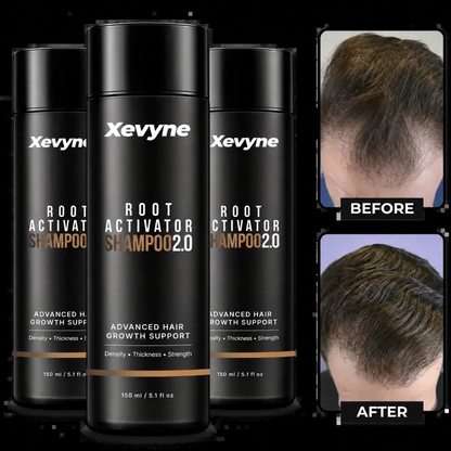 Xevyne™ Root Activator Shampoo 2.0